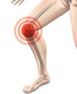 knee injury illustration